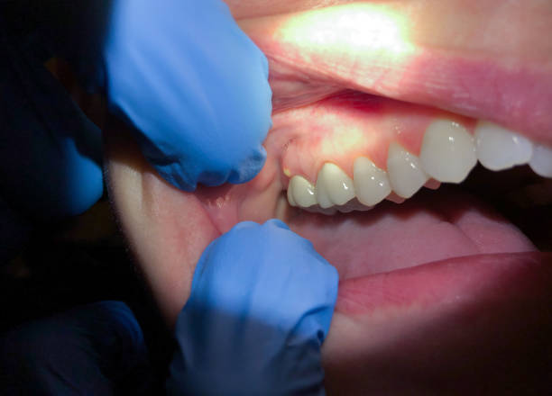 Best Same-Day Emergency Dental Services in Fairmont, WV